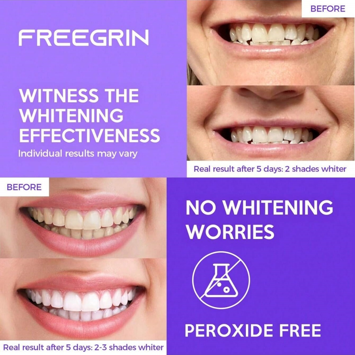 Deluxe Whitening Teeth Sticker - Home Fragrance Gel ulasan dan harga
